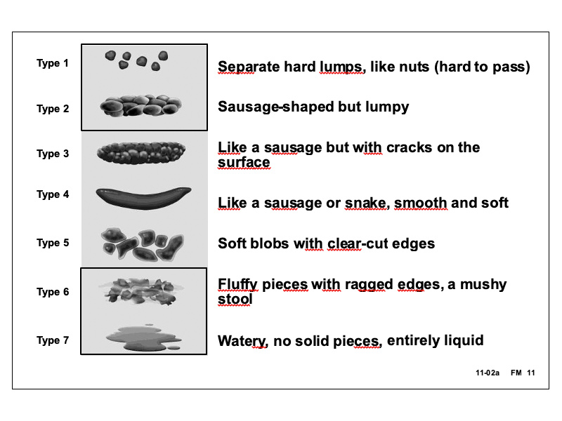 IBS Subtypes